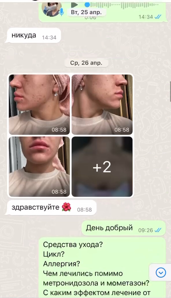 Данная пациентка обратилась за дистанционной консультацией с другого города с жалобами на высыпания, возникшие после массажа лица. 