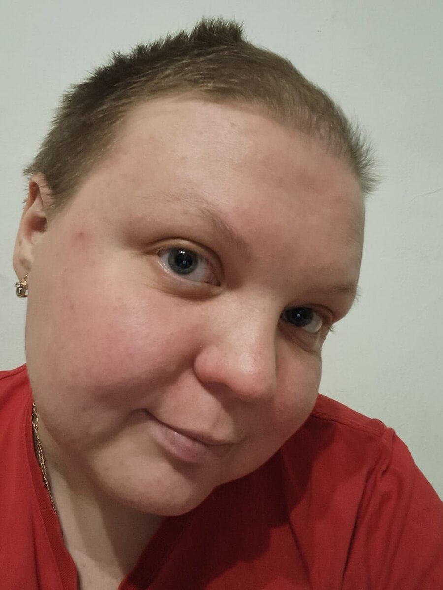 А это я не колю дексу уже 1,5 месяца.