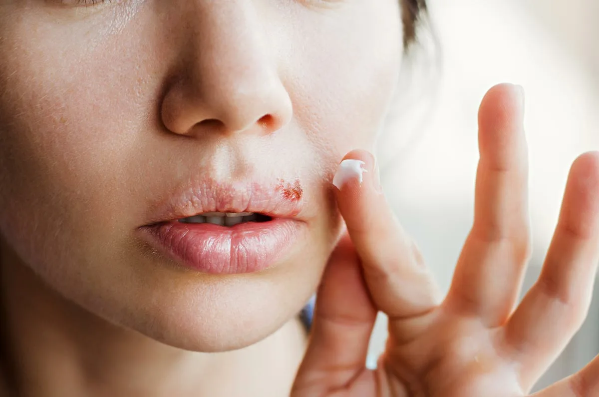 Любое заболевание найдет свое отражение в полости рта, иногда, кроме симптомов, вследствие патологических изменений ухудшается ее состояние.