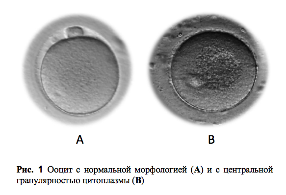 Ооцит размер. Оценка ооцита м2. Гранулярность.