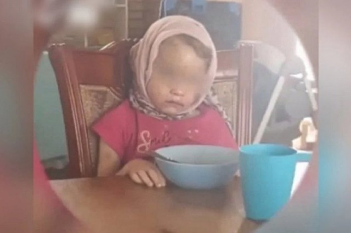    Приемный ад: у избитой девочки из Могочино диагностирован некроз мозга