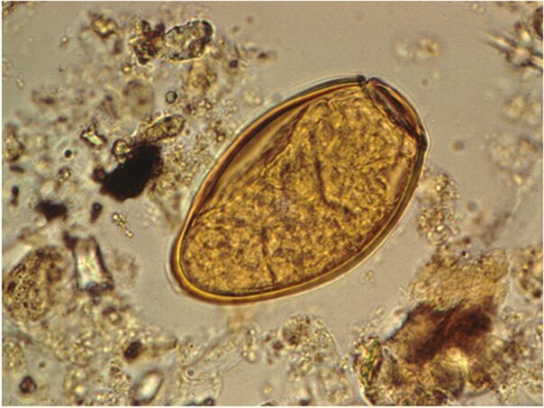 Источник фото: https://sun9-42.userapi.com/impf/c636817/v636817320/5690d/wIK5edgeXok.jpg?size=604x453&quality=96&sign=24cfb6508dcd45bc7ca0a7ab481fb4f6&type=album