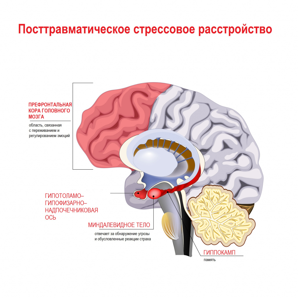 Птср картинки для презентации