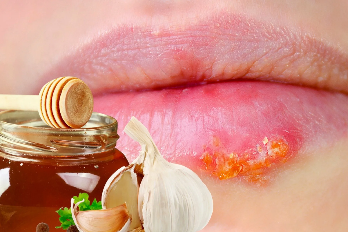 вышла простуда