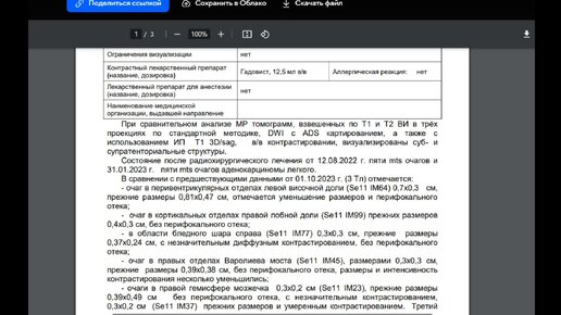 РЕЗУЛЬТАТ МРТ ИЗВЕСТЕН, ПЛЕВРАЛЬНАЯ ПУНКЦИЯ ПОЗАДИ