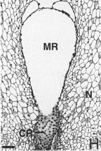 Именно этот этап развития показан на микрофотографии.      Источник рисунка - Friedman, W. E., J. S. Carmichael. 1998. Heterochrony and developmental innovation: Evolution of female gametophyte ontogeny in Gnetum, a highly apomorphic seed plant. Evolution 52: 1016–1030