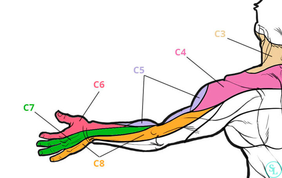 защемило нерв болит рука. защемление нервов в руке.