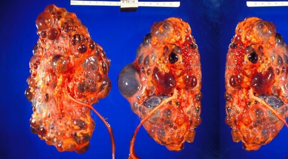   Edwin P. Ewing / Wikimedia Commons / Public Domain