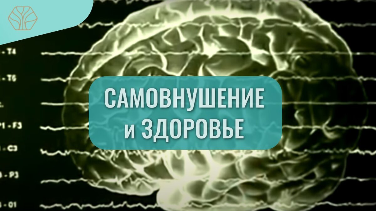 Мысли материальны? Секреты нашего мозга и как метод самовнушения помогает  быть здоровым | Древмасс | Дзен