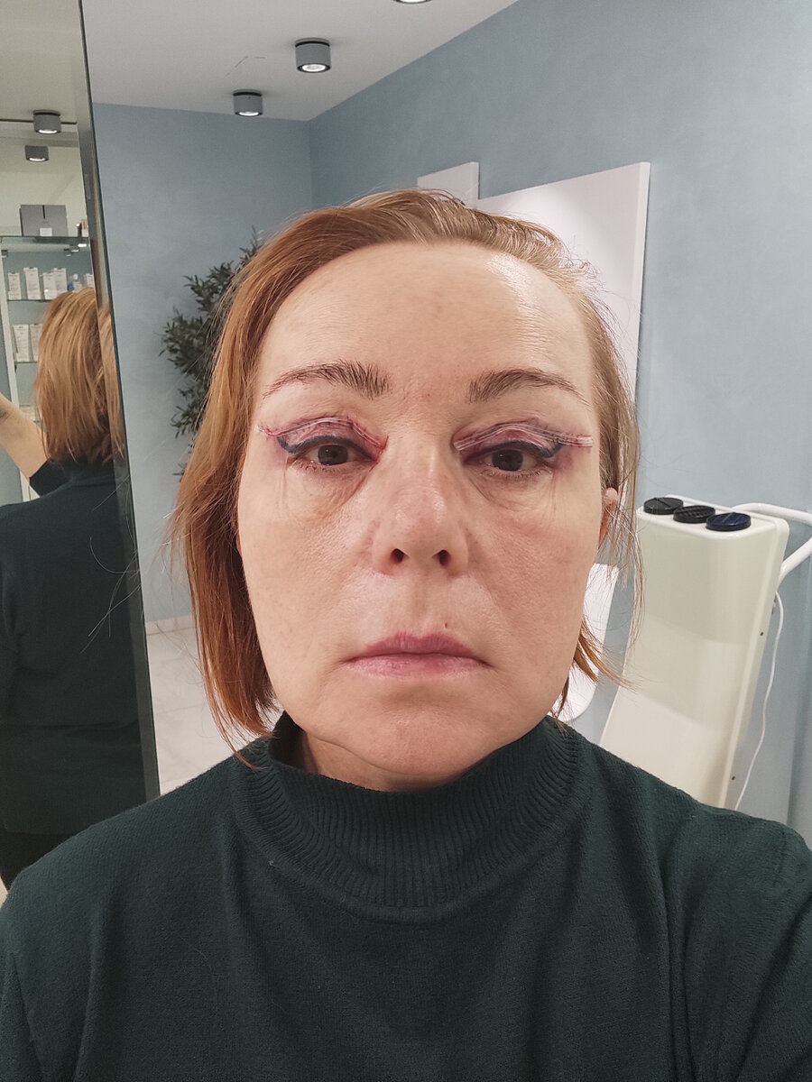 Буквально сразу после. Стах просто как выглядит. Ну ничего. Всё проходит, и это тоже пройдёт...