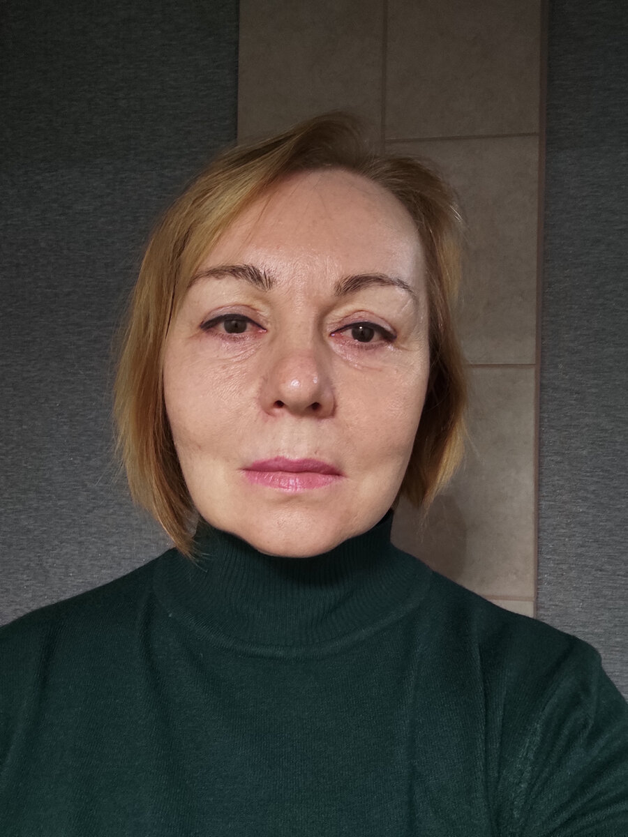 Перед операцией