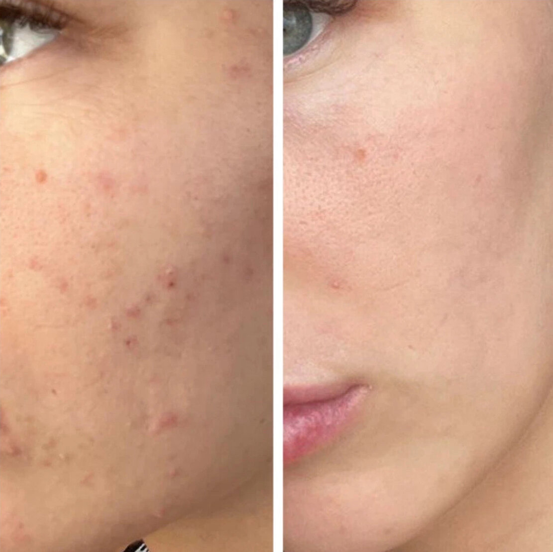 До / после лечения в формате онлайн