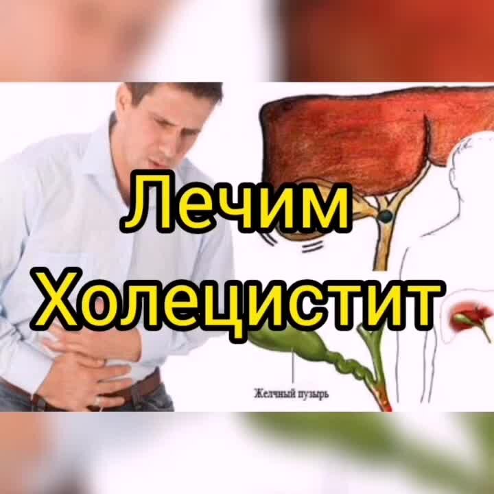 Классификация холецистита