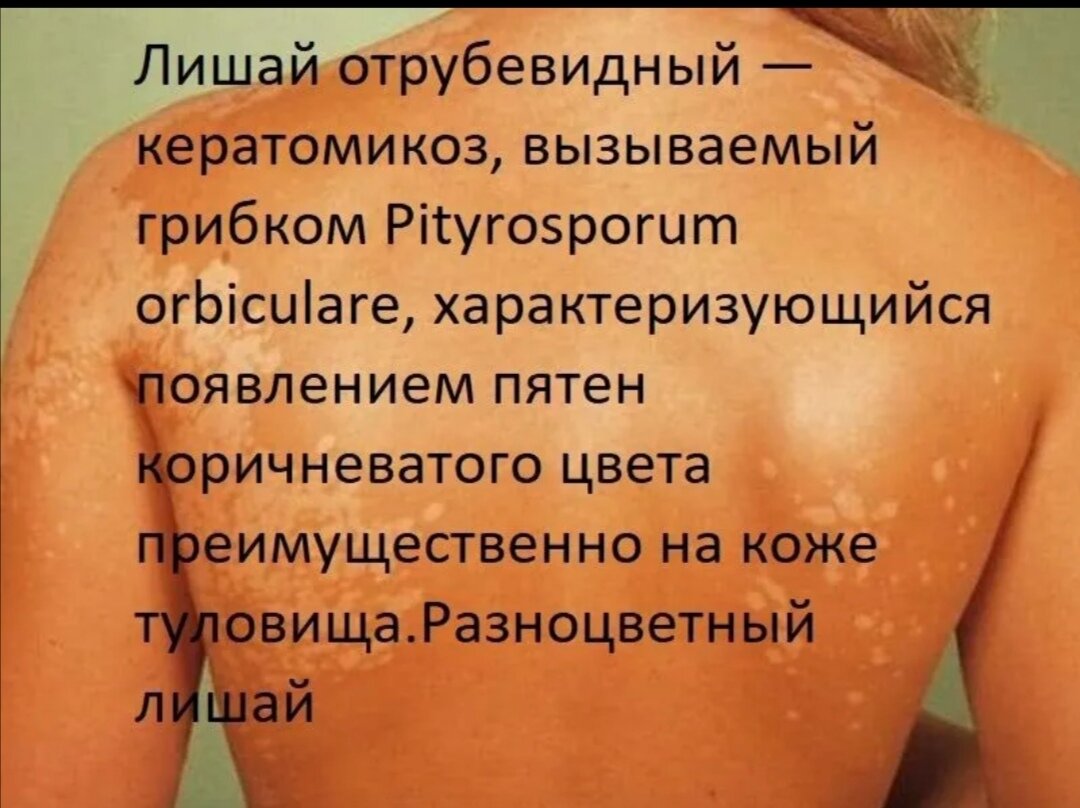 Лишаться форум