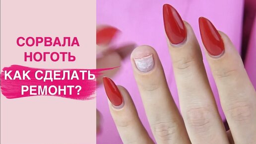 У меня СЛОМАЛСЯ ноготь | Делать ли ремонт?