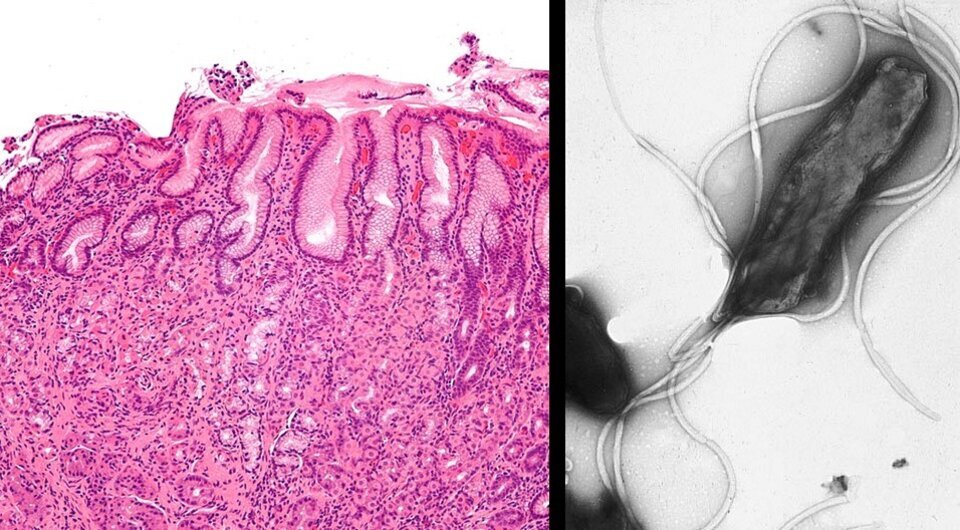   N + 1; Nephron / Wikimedia Commons / CC-BY-SA-3.0; Yutaka Tsutsumi / Wikimedia Commons / Public Domain