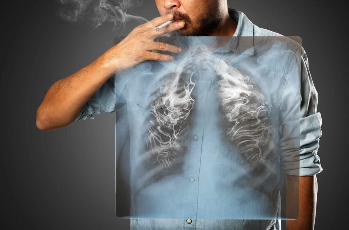    Положительный эффект после отказа от курения можно заметить уже через пару дней