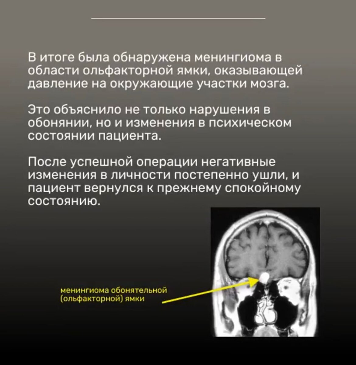 Опухоль головного мозга | Vrachi.insta | Дзен