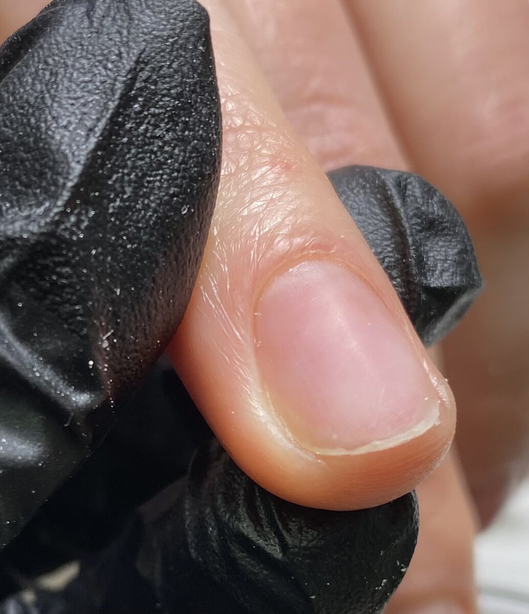 Ноготок до. 