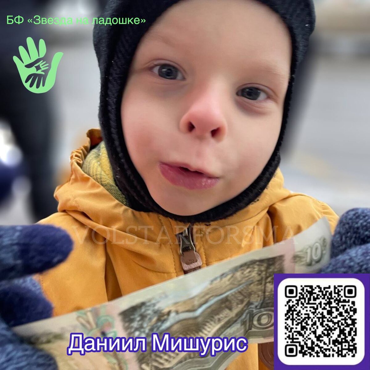 Почему в нашем мире здоровье детей зависит от денег?Мы не можем ответить на этот вопрос однозначно, но знаем, что в нашем мире очень много ОТЗЫВЧИВЫХ людей, готовых прийти на помощь по первому зову.И если вы тот человек, то мы очень просим вас о помощи малышу, чьи родители не могу собрать сумму на срочную операцию 🙏Даниил Мишурис, родился без слуховых проходов с двух сторон. Вся жизнь малыша сейчас- это больницы, операции и реабилитации. В 2 года Дане сделали первую операцию по открытию слухового прохода и она прошла успешно!Сейчас необходимо собрать на операцию по открытию второго ушного канала. Стоимость ее 5 566 940 рублей - это баснословные деньги семья собирает больше года!Мы просим, нет мы умоляем помочь семье Дане в закрытии сбора. Помощь может быть абсолютно любой - если есть возможность и желание, можете распечатать листовки и раздать в магазинах, или помочь любой суммой, или поделиться этой информации в своих соцсетях, или рассказать о Дане человеку, который может помочь.Вы сделаете огромное и благородное дело, а у семьи появится шанс на выздоровлении сына🙏Сделать волшебство для Дани можно:✨смс Ладошка 200 на номер 3434, где 200 - любая сумма;✨на сайте фонда любым удобным способом.https://starforsma.ru/children/daniil-mishuris✨Присоединиться к команде волонтеров фонда, помогающих Даниилу Мишурису https://t.me/obvolstarforsma✨Принять участие в благотворительной лотерее в наших социальных сетях  @lotteryvolstarforsma #даниилмишурис #срочныйсбор #звезданаладошке #волонтерызвезданаладошке#детицветы #особенныедетки