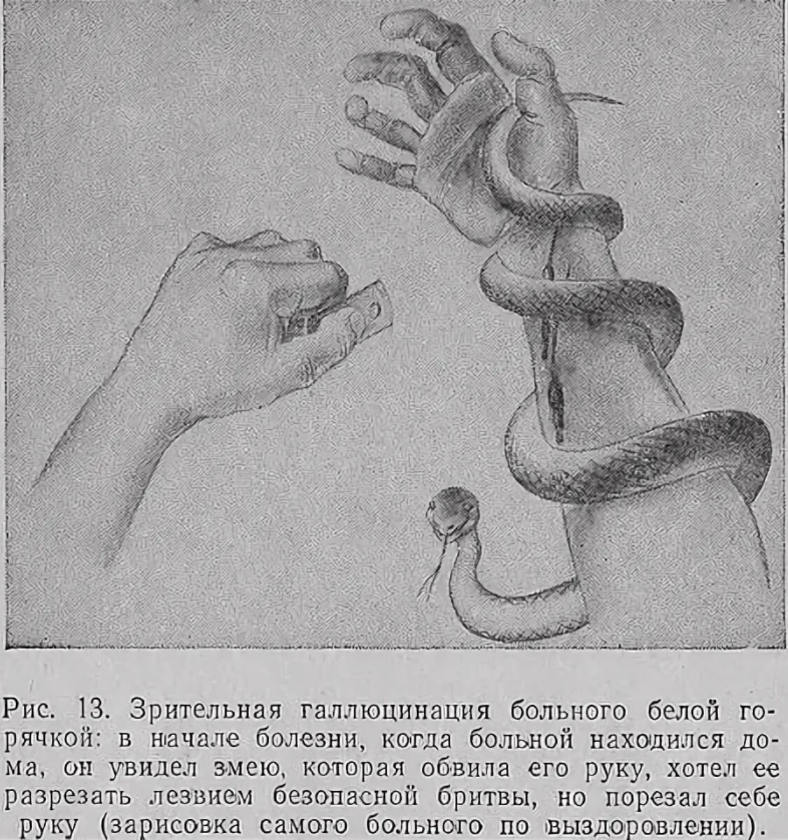 Белая горячка галлюцинации. Галлюцинации при белой горячке. Алкогольный психоз делирий. Алкогольный делирий рисунки больных. Алкогольные галлюцинации.
