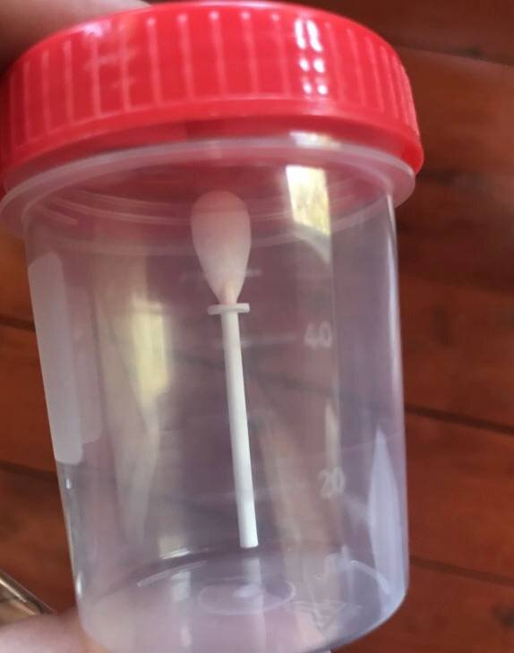 пример емкости для сдачи кала