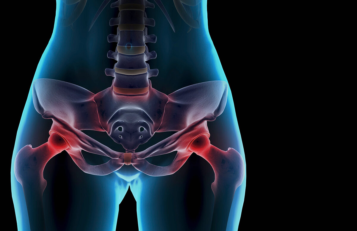 тест на грушевидную мышцу. крестцовая кость болит. боли в крестце и бедрах. седалищный нерв левой ягодицы. боли в крестце и бедрах.