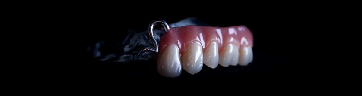 Готовый бюгельный протез.