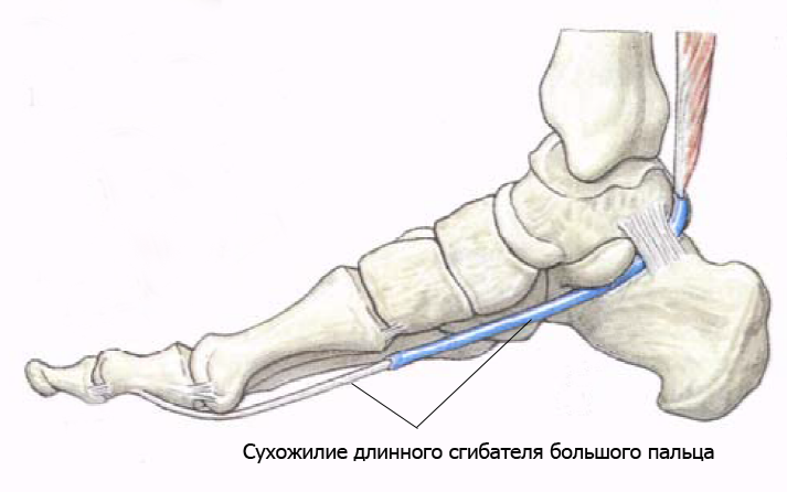 Теносиновит сухожилия сгибателей стопы. Сухожилие сгибателя большого пальца стопы. Длинный сгибатель большого пальца стопы анатомия. Сухожилие сгибателя 1 пальца стопы. Длинный сгибатель большого пальца стопы стопы.