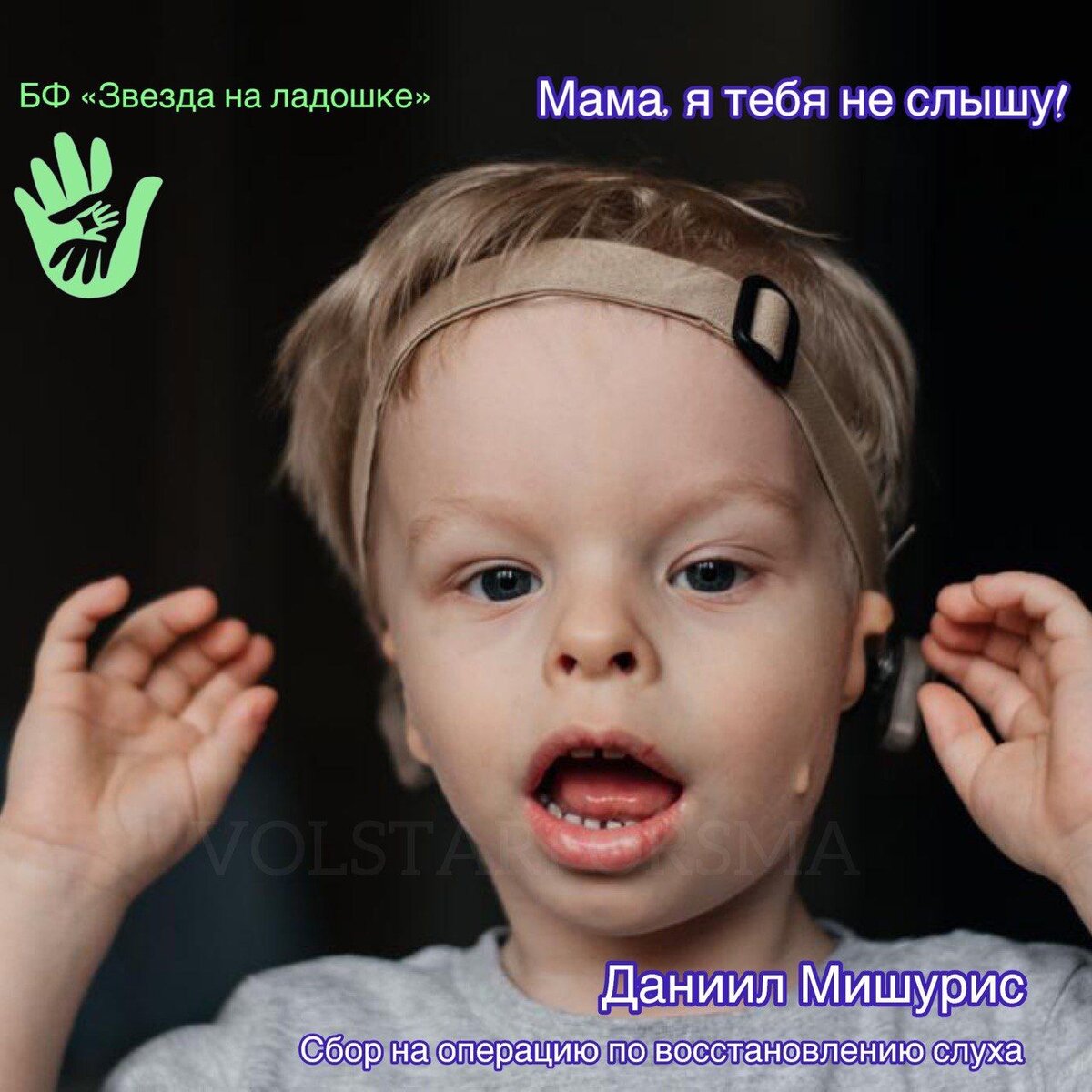 Нельзя здоровым быть наполовину!
Наполовину слышать и жить при этом полноценно невозможно.

Хороший слух очень важен для каждого человека. Это возможность не сомневаться в том, верно ли вы услышали собеседника, свободно говорить по телефону, не волноваться из-за пропущенных слов, не теряться, когда говорит больше одного человека. 

Представляете, сколько нужной информации из внешнего мира теряет ребенок с нарушением слуха?

У Дани Мишуриса с рождения тяжелая степень тугоухости на оба ушка. С помощью операции ему восстановили слух с одной стороны, но для полноценной жизни этого мало. Только вторая операция сможет избавить малыша от тяжелого недуга. 
Стоимость операции огромная для простой семьи - 5 566 490р. Очень нужна Ваша помощь. 


Помочь Данечке можно:

✨ смс на номер 3434 с текстом Ладошка 200, где 200 - любая сумма;

✨ на сайте фонда любым удобным способом 
https://starforsma.ru/children/daniil-mishuris

✨ Присоединиться к команде волонтеров фонда, помогающих Даниилу Мишурису https://t.me/obvolstarforsma

✨ Принять участие в благотворительной лотерее в наших социальных сетях  @lotteryvolstarforsma

#даниилмишурис #срочныйсбор #звезданаладошке #волонтерызвезданаладошке #детицветы #особенныедетки