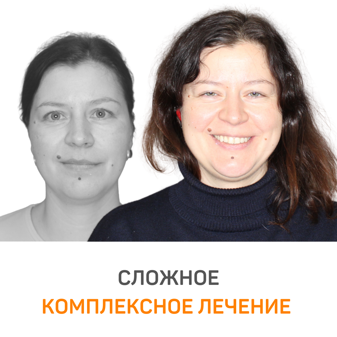 📸 все фотографии публикуются с разрешения пациента