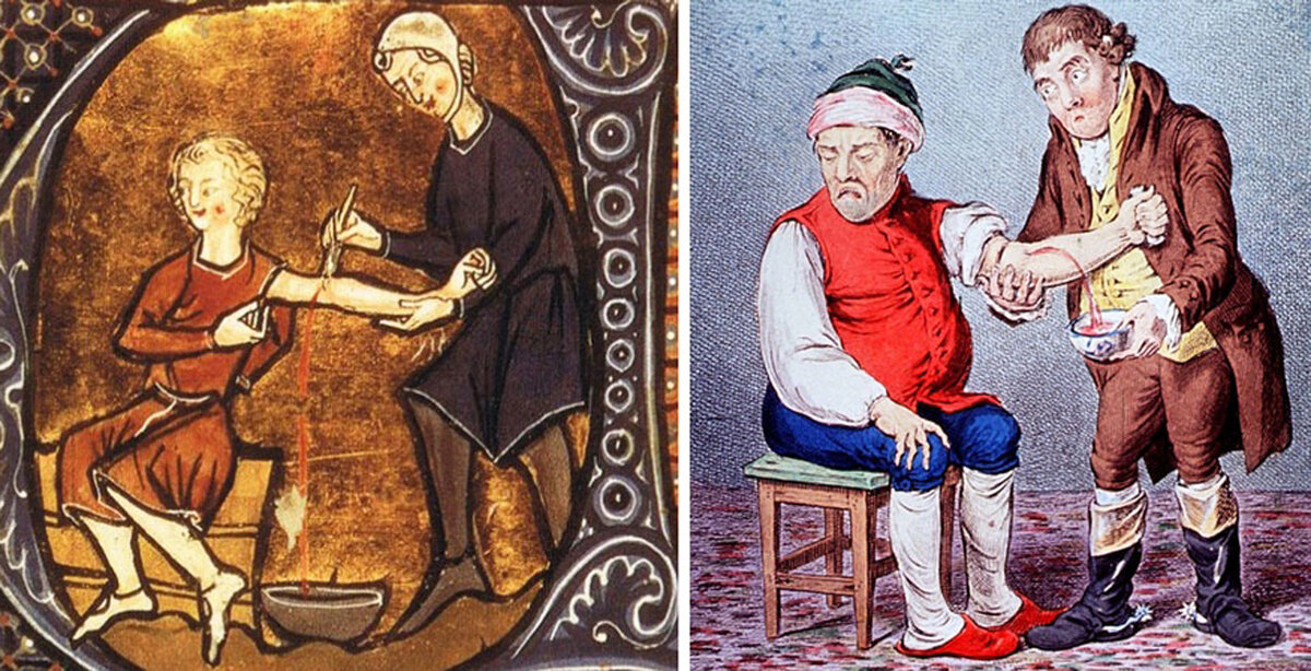 În zilele noastre, multe boli mintale sunt tratate cu medicamente moderne, dar nu a fost întotdeauna cazul.-3