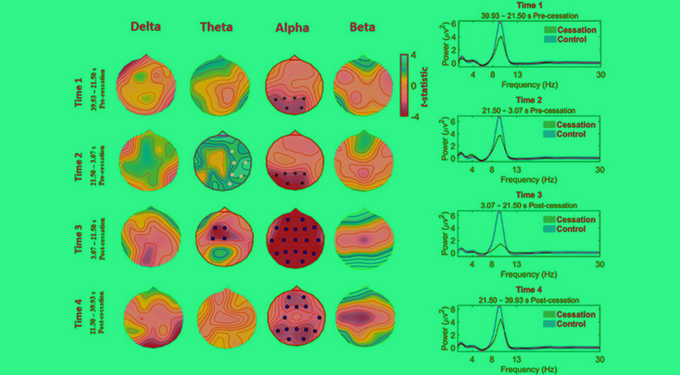   N + 1; Avijit Chowdhury et al. / Neuropsychologia, 2023