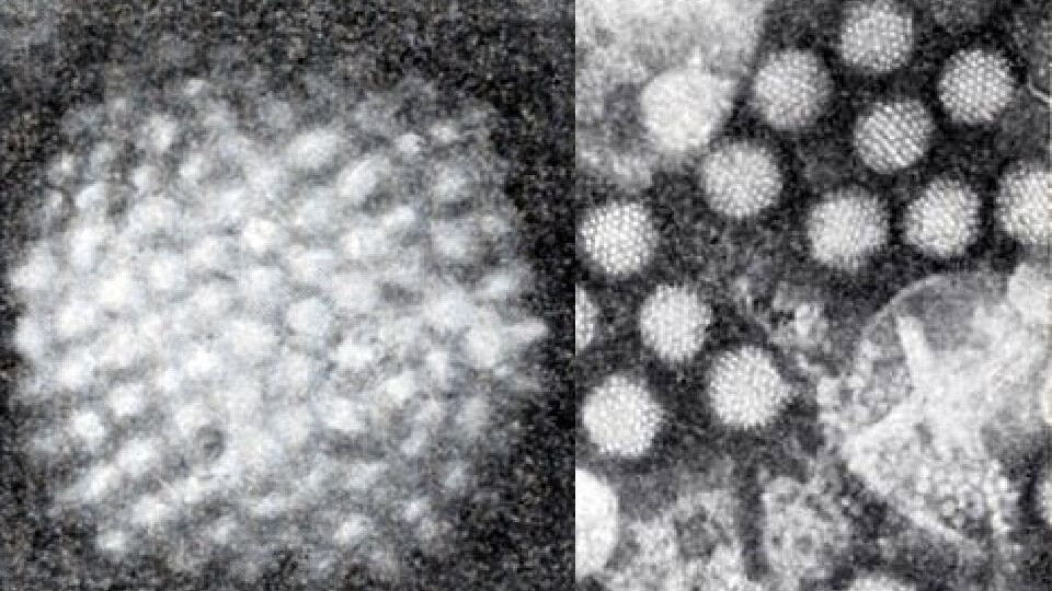 Кто виноват в том, что ваш ребенок в саду часто болеет? Правда об аденовирусной инфекции
