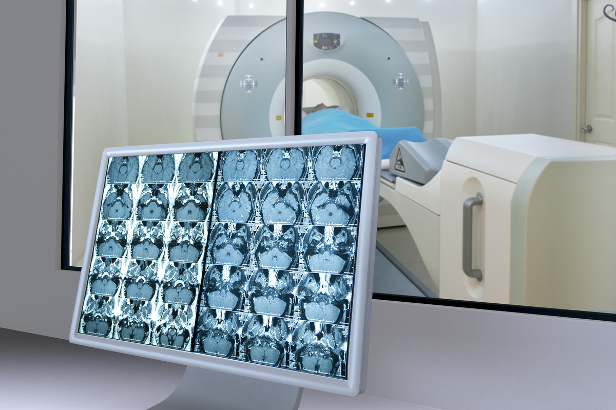 Медицинские процедуры могут быть пугающими, включая передовые технологии визуализации, такие как магнитно-резонансная томография (МРТ).-2