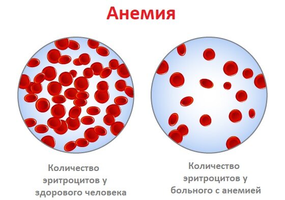 Здравствуйте, мои дорогие слушатели, ученики, пациенты и коллеги! 🙂По Вашим письмам и отзывам я вижу, что тема здоровья крови Вам очень интересна.-2