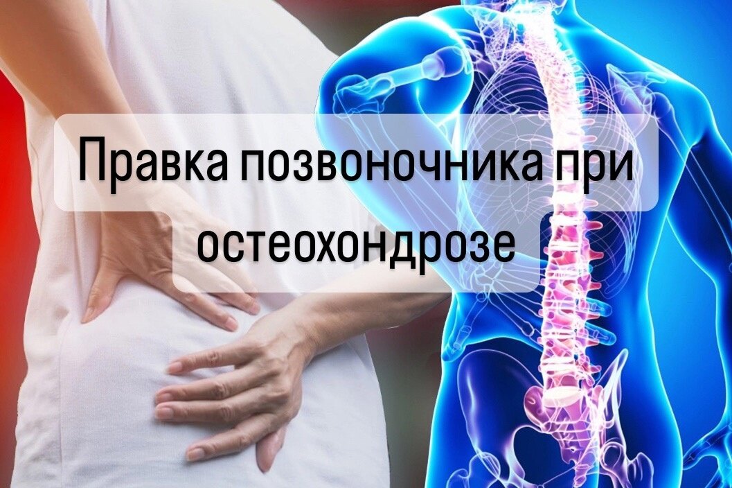 Остеохондроз