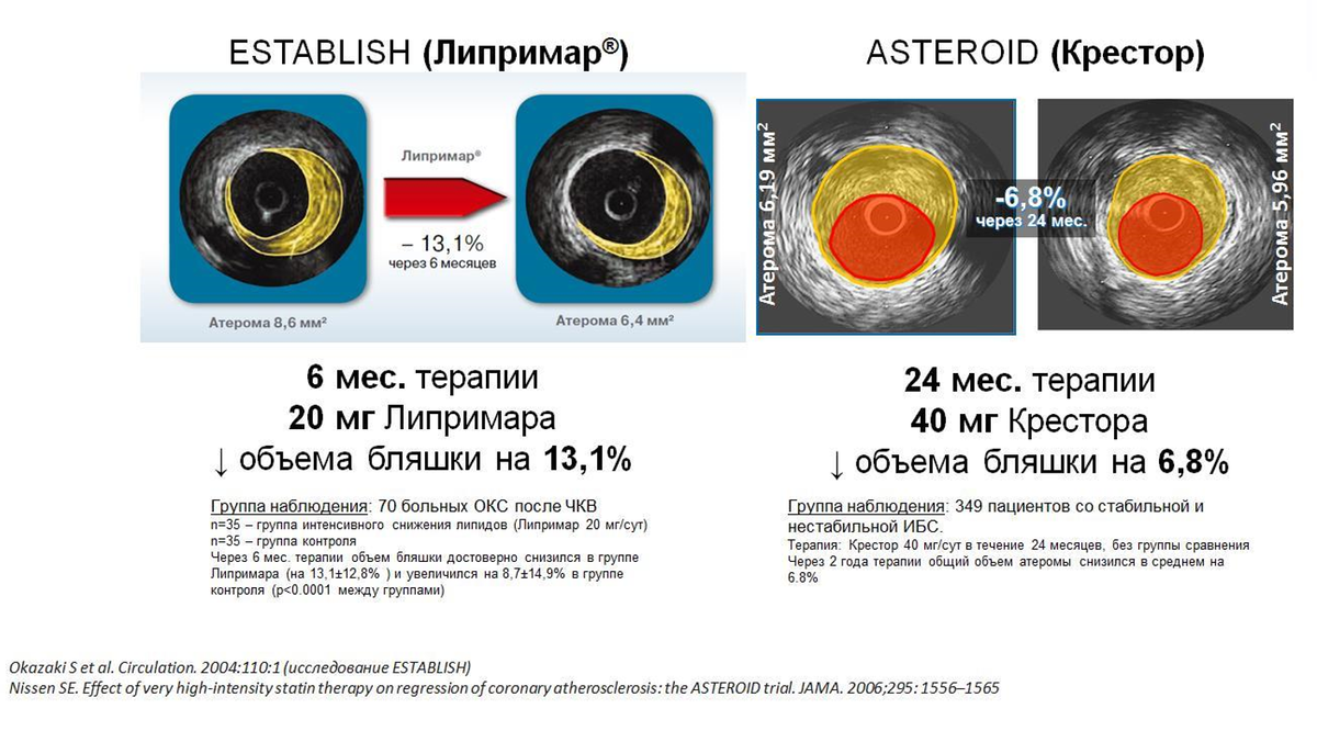 Лечение атеросклероза сосудов