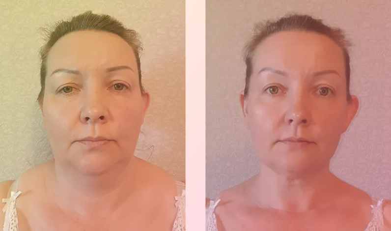 Фото для примера взято из интернента.