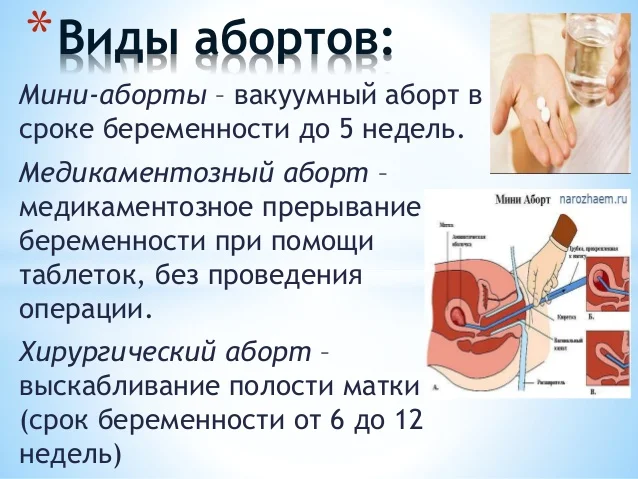 Вакуум оборот. Платное прерывание беременности. Вакуумный аборт (мини-аборт). Прерывание беременности вакуумом. Сколько стоит делать аборт.