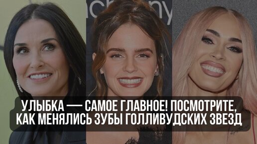 Улыбка — самое главное! Посмотрите, как менялись зубы голливудских звезд