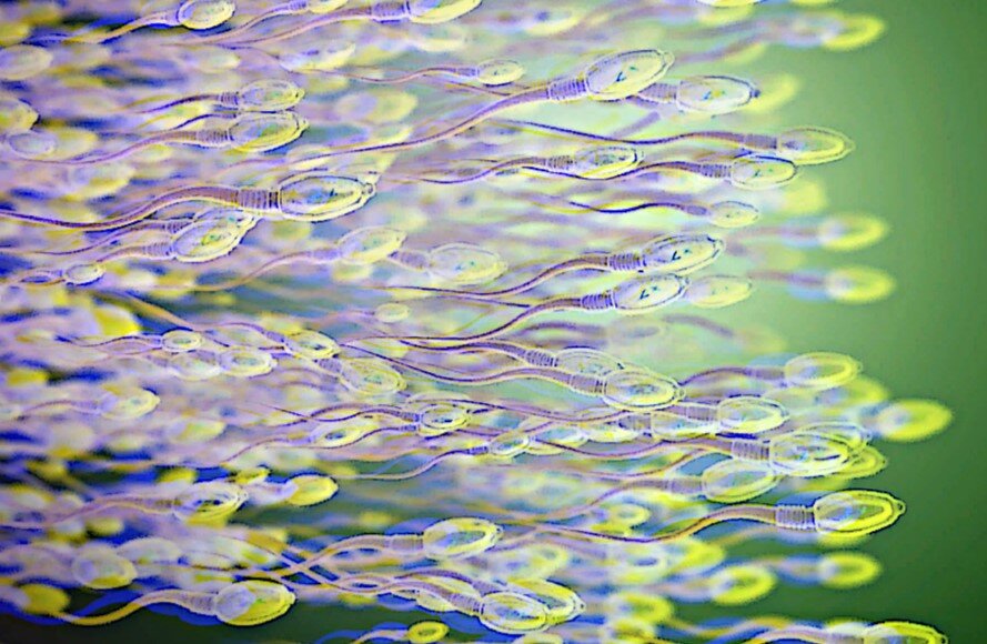 Сперматозоиды после разжижения. Рисунок взят из открытых источников.