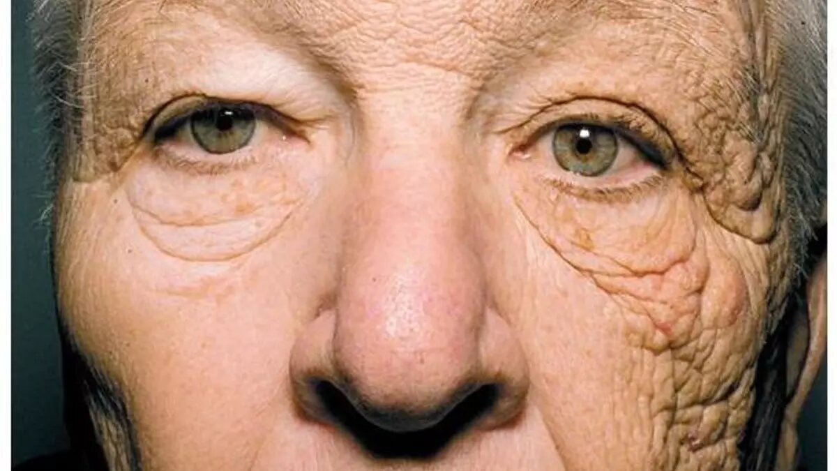     Американские ученые сделали открытие, которое во многом прояснило природу человеческого старения.