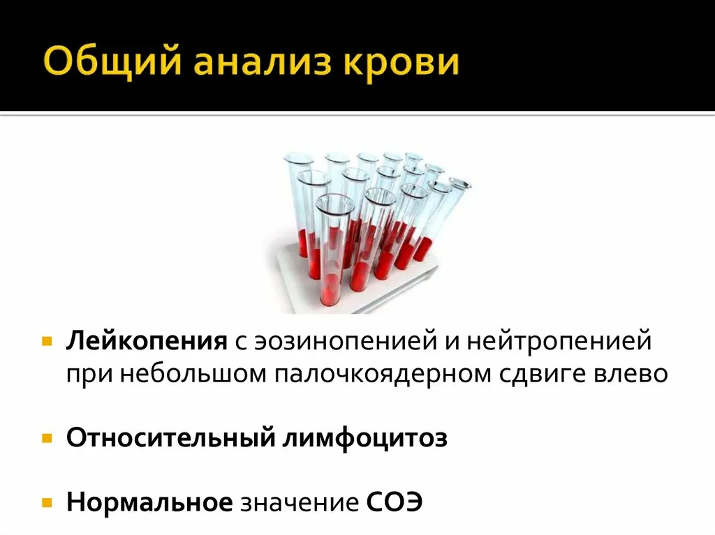 Анализ на грибок ногтей расшифровка. Клинический анализ крови при вирусной инфекции у ребенка. Биохимия орви. Биохимия орви. Анализ крови при пневмонии показатели.