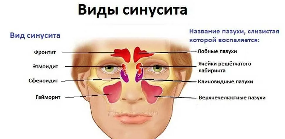 Рис.1