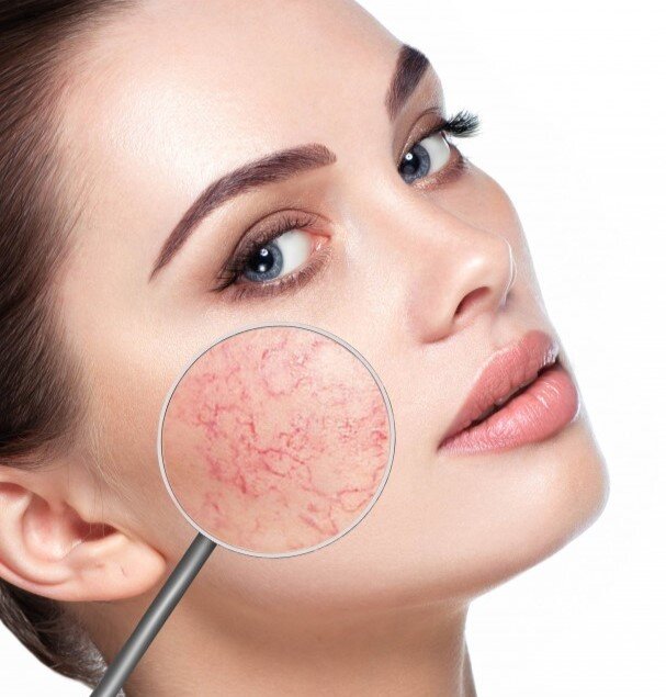 Фото взято из открытых источников.