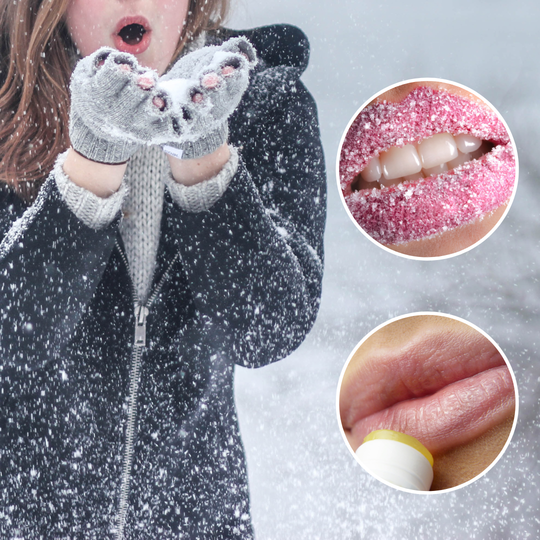 Как защитить губы зимой: правила выживания
