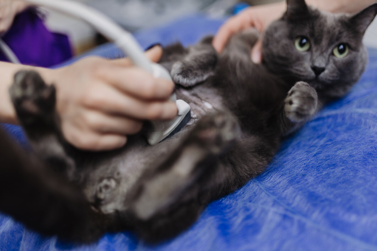 Шаня на ультразвуковом исследовании