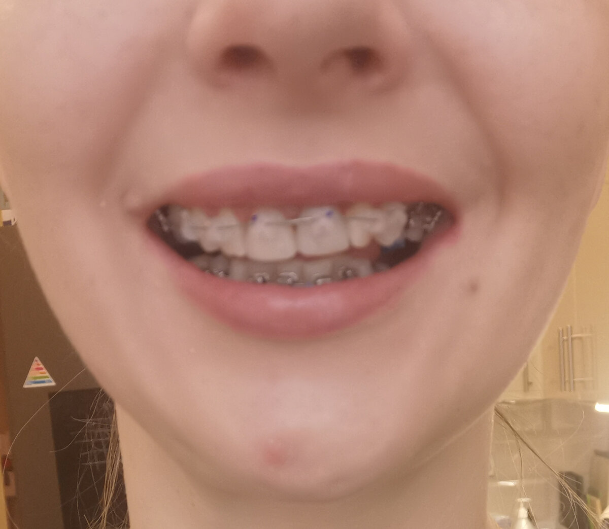 Сразу после установки