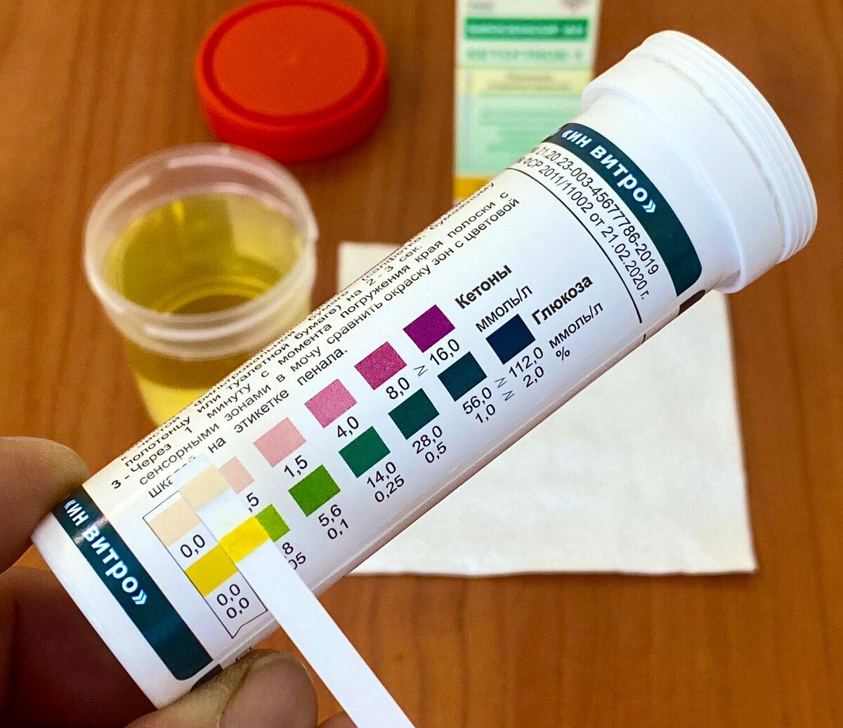Фото из открытых источников - пример самостоятельного измерения кетоновых тел в моче